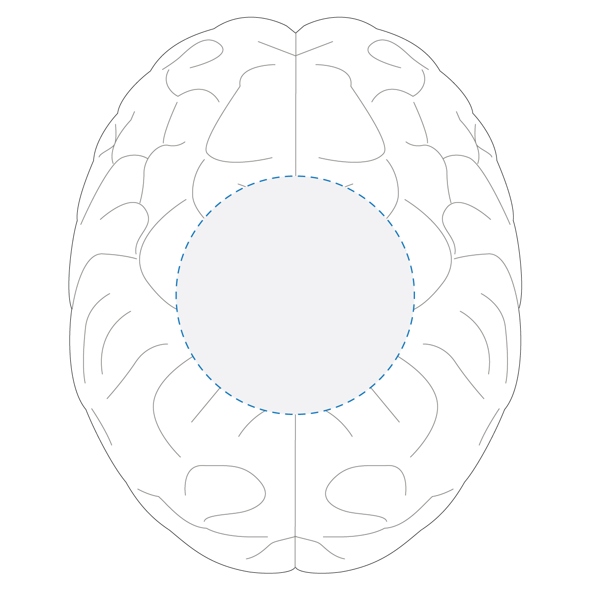 Pad Print Decoration Area 1