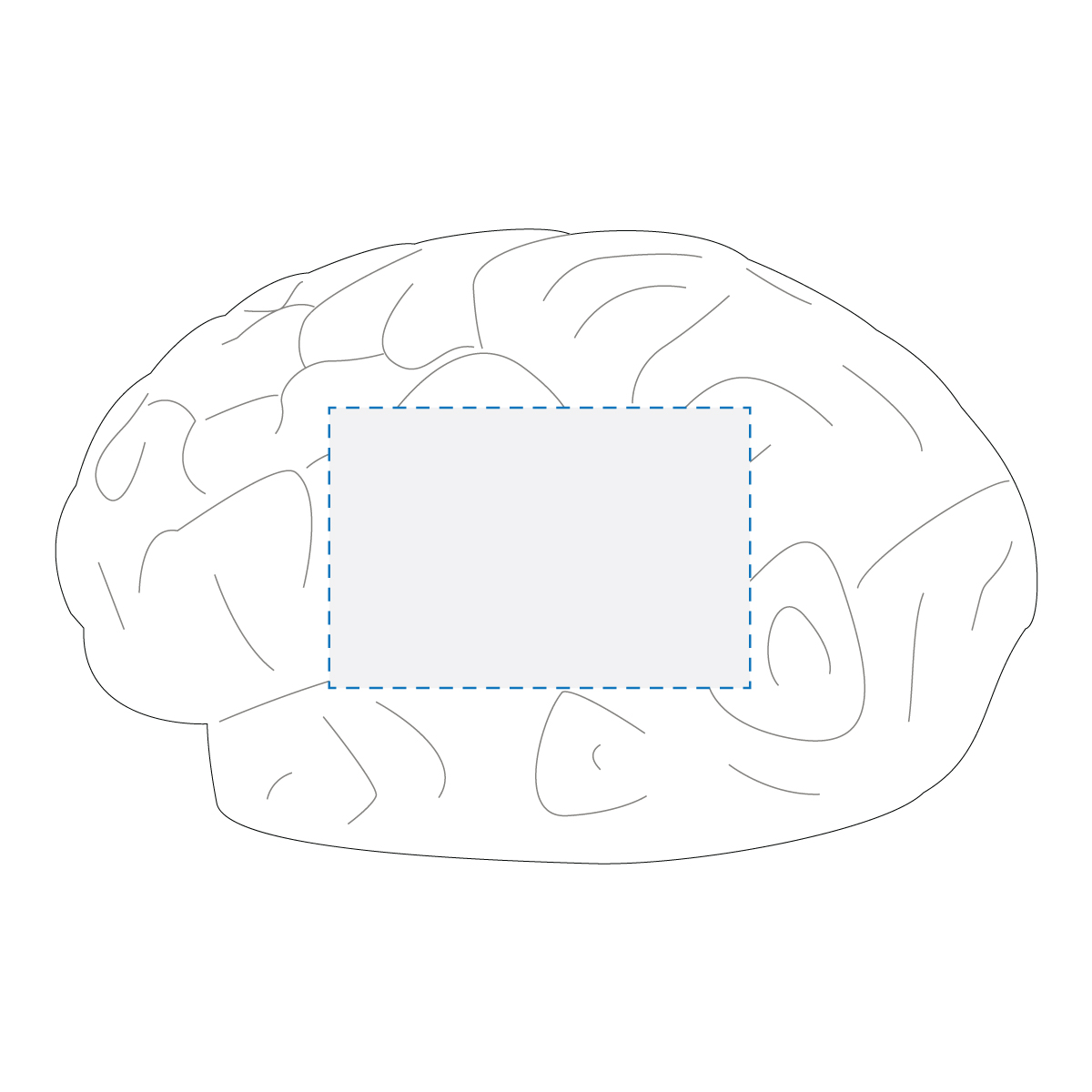 Pad Print Decoration Area 2